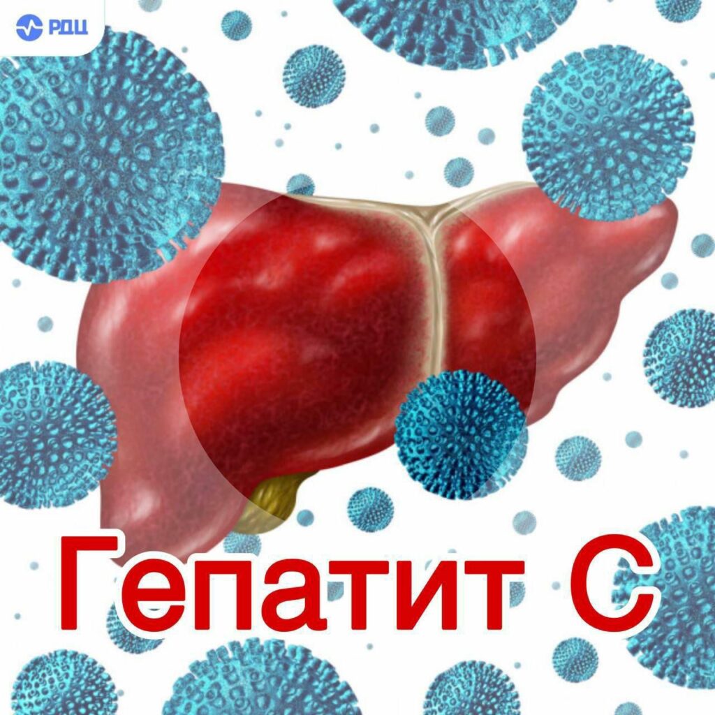 Гепатит С